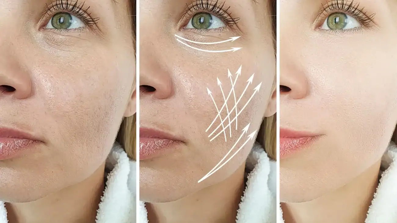 Can One Treatment Really Tackle More Than One Skin Concern Buckinghamshire?