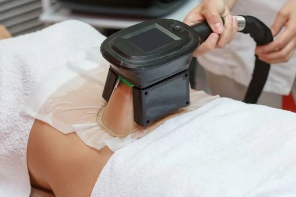 Image of person having fat freezing treatment to help weight gain Buckinghamshire