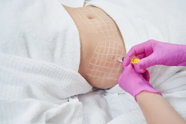 image of fat dissolving injections on love handles to help combat weight gain Buckinghamshire