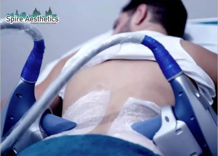 Man having fat freezing treatment done on love handles before a competitions Buckinghamshire to create a sculpted look.