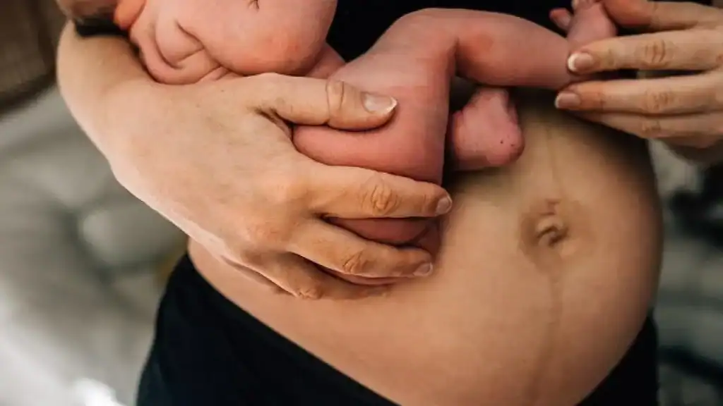 Why Is My Stomach Still Big After Pregnancy Buckinghamshire?